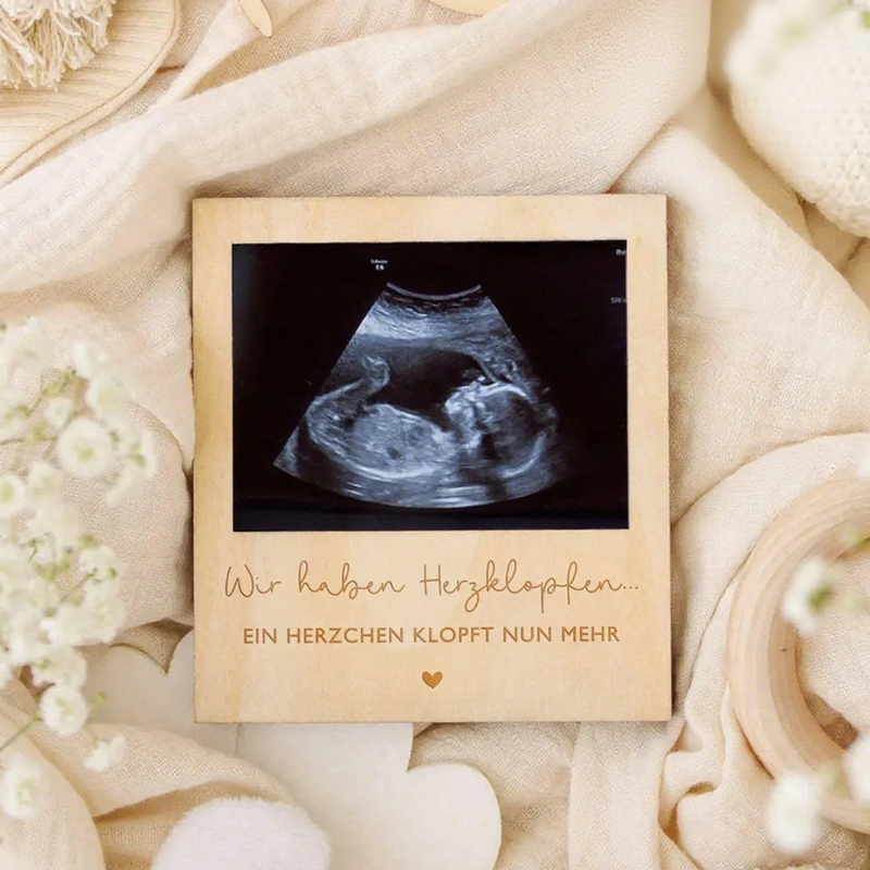 Ultrasound Pregnancy Announcem - Baby Nursery Images review and price